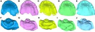 Novel digital technique for measuring the volumetric healing process of free gingival grafts surrounding dental implants